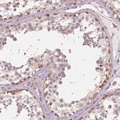 Anti-EPHB1 antibody produced in rabbit Prestige Antibodies® Powered by Atlas Antibodies, affinity isolated antibody