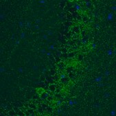 Monoclonal Anti-GAD1 antibody produced in mouse Prestige Antibodies® Powered by Atlas Antibodies, clone CL2914, purified immunoglobulin, buffered aqueous glycerol solution