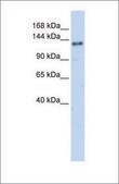 Anti-EIF4G2 antibody produced in rabbit affinity isolated antibody