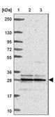 Anti-MRPL16 antibody produced in rabbit Prestige Antibodies&#174; Powered by Atlas Antibodies, affinity isolated antibody, buffered aqueous glycerol solution