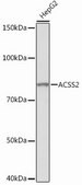 Anti-ACSS2 antibody produced in rabbit