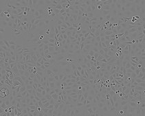 KYSE-30 NOTE: Both the cell line and DNA from the cell line may be available for this product. Please choose -1VL or VIAL for cells, or -DNA-5UG for DNA, 94072011, human esophagus, Polygonal