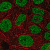 Anti-PBRM1 antibody produced in rabbit Prestige Antibodies&#174; Powered by Atlas Antibodies, affinity isolated antibody