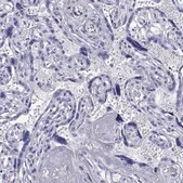 Anti-KIAA2012 antibody produced in rabbit Prestige Antibodies® Powered by Atlas Antibodies, affinity isolated antibody, buffered aqueous glycerol solution