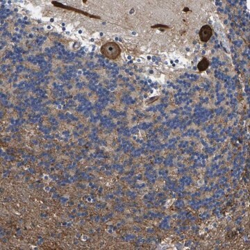 Anti-KIAA1551 antibody produced in rabbit Prestige Antibodies&#174; Powered by Atlas Antibodies, affinity isolated antibody, buffered aqueous glycerol solution