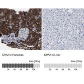 Anti-CPA2 antibody produced in rabbit Prestige Antibodies® Powered by Atlas Antibodies, affinity isolated antibody, buffered aqueous glycerol solution, Ab2