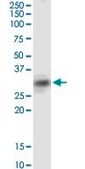 Monoclonal Anti-SIRT4, (C-terminal) antibody produced in mouse clone 1C8, purified immunoglobulin, buffered aqueous solution