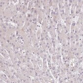 Anti-BARD1 antibody produced in rabbit Prestige Antibodies&#174; Powered by Atlas Antibodies, affinity isolated antibody, buffered aqueous glycerol solution