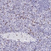 Anti-CD7 antibody produced in rabbit Prestige Antibodies® Powered by Atlas Antibodies, affinity isolated antibody, buffered aqueous glycerol solution