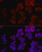 Anti-NUDT5 Antibody, clone 7Y9M2, Rabbit Monoclonal