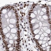 Anti-NUMA1 antibody produced in rabbit Prestige Antibodies&#174; Powered by Atlas Antibodies, affinity isolated antibody, buffered aqueous glycerol solution