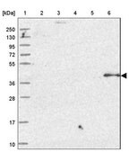 Anti-OSGEP antibody produced in rabbit Prestige Antibodies&#174; Powered by Atlas Antibodies, affinity isolated antibody, buffered aqueous glycerol solution