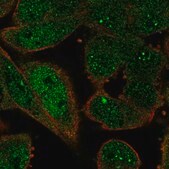 Anti-ZWINT antibody produced in rabbit Prestige Antibodies&#174; Powered by Atlas Antibodies, affinity isolated antibody, buffered aqueous glycerol solution, ab2