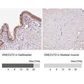抗-ONECUT2 兔抗 Prestige Antibodies® Powered by Atlas Antibodies, affinity isolated antibody, buffered aqueous glycerol solution
