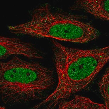 Anti-SFMBT1 antibody produced in rabbit Prestige Antibodies&#174; Powered by Atlas Antibodies, affinity isolated antibody