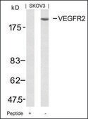 Anti-KDR (Ab-951) antibody produced in rabbit affinity isolated antibody