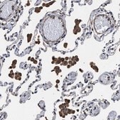 Anti-TSPAN33 antibody produced in rabbit Prestige Antibodies&#174; Powered by Atlas Antibodies, affinity isolated antibody, buffered aqueous glycerol solution