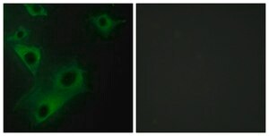 Anti-CIDEC, C-Terminal antibody produced in rabbit affinity isolated antibody