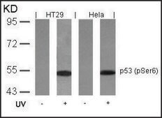 Anti-phospho-TP53 (pSer6) antibody produced in rabbit affinity isolated antibody