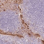 Anti-RPTN antibody produced in rabbit Prestige Antibodies&#174; Powered by Atlas Antibodies, affinity isolated antibody, buffered aqueous glycerol solution