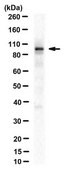 抗CTIP2 / BCL11B抗体，克隆25B6 clone 25B6, from rat