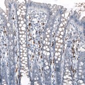 Anti-APOBEC3A antibody produced in rabbit Prestige Antibodies® Powered by Atlas Antibodies, affinity isolated antibody, buffered aqueous glycerol solution