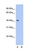 Anti-PCBP1 antibody produced in rabbit IgG fraction of antiserum