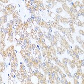 Anti-CHD1 antibody produced in rabbit