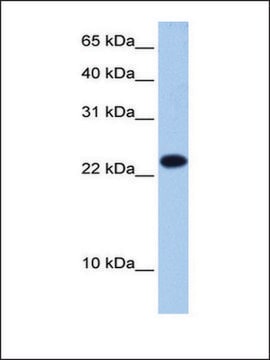 Anti-EIF4E3 antibody produced in rabbit affinity isolated antibody