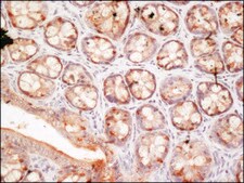 Anti-FUS (internal) antibody produced in rabbit ~1.0 mg/mL, affinity isolated antibody