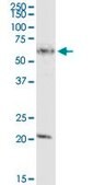 Anti-MCCC2 antibody produced in rabbit purified immunoglobulin, buffered aqueous solution