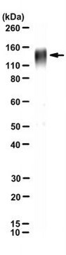 Anti-Envelope glycoprotein B Antibody, HCMV Antibody, clone 27-156