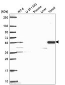 Anti-TTC39C antibody produced in rabbit Prestige Antibodies&#174; Powered by Atlas Antibodies, affinity isolated antibody