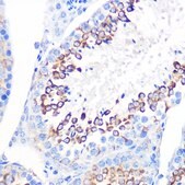 Anti-CD59 antibody produced in rabbit