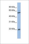 Anti-NR0B1 antibody produced in rabbit affinity isolated antibody