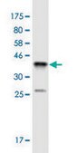 Monoclonal Anti-SSX4 antibody produced in mouse clone 3E10, ascites fluid
