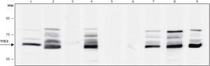 Anti-TFE3 antibody produced in rabbit affinity isolated antibody, buffered aqueous solution