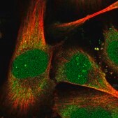 Anti-THYN1 antibody produced in rabbit Prestige Antibodies&#174; Powered by Atlas Antibodies, affinity isolated antibody, buffered aqueous glycerol solution
