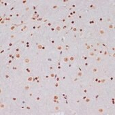 Anti-Acetyl-Histone H3-K9/K14/K18/K23/K27 antibody produced in rabbit