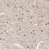 Anti-OSBPL7 antibody produced in rabbit Prestige Antibodies® Powered by Atlas Antibodies, affinity isolated antibody, buffered aqueous glycerol solution