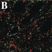 抗-聚唾液酸-NCAM抗体，克隆2-2B ascites fluid, clone 2-2B, Chemicon&#174;