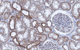 Anti-PI-3 kinase p110α Antibody, clone 1J4 ZooMAb® Rabbit Monoclonal recombinant, expressed in HEK 293 cells