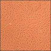 Human Chondrocytes - Rheumatoid Arthritis: HC-RA, adult