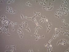 sLT-RMS Spontaneous Lung-tropic RET Melanoma-sorted Mouse Cell Line