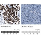 抗-AMACR 兔抗 affinity isolated antibody, buffered aqueous glycerol solution