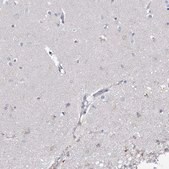 Anti-ECHDC3 antibody produced in rabbit Prestige Antibodies&#174; Powered by Atlas Antibodies, affinity isolated antibody, buffered aqueous glycerol solution