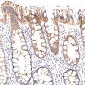 Anti-VPS45 antibody produced in rabbit Prestige Antibodies&#174; Powered by Atlas Antibodies, affinity isolated antibody, buffered aqueous glycerol solution