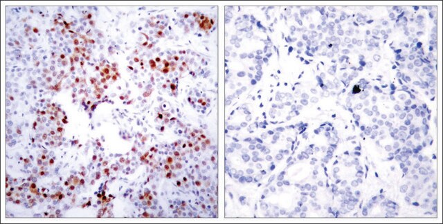 Anti-ATF2 (Ab-69 or 51) antibody produced in rabbit affinity isolated antibody