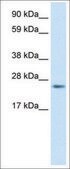 Anti-FADD (AB1) antibody produced in rabbit affinity isolated antibody