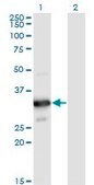 Monoclonal Anti-MYOZ2 antibody produced in mouse clone 1D4, purified immunoglobulin, buffered aqueous solution